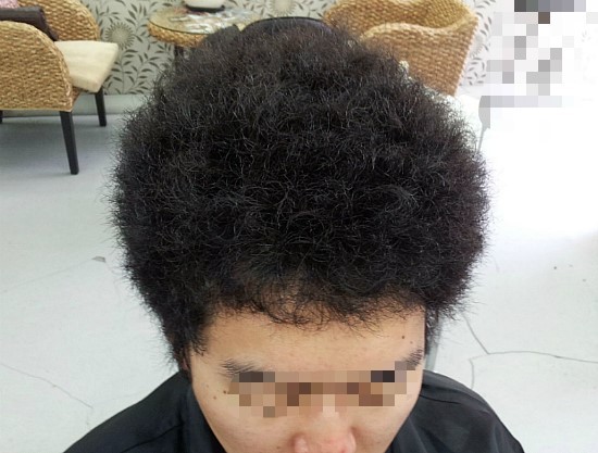 곱슬머리 이미지