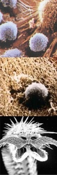 면역세포와 암세포, 그리고 슈퍼박테리아 사진　