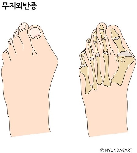 2310E9425281F5A309B01A