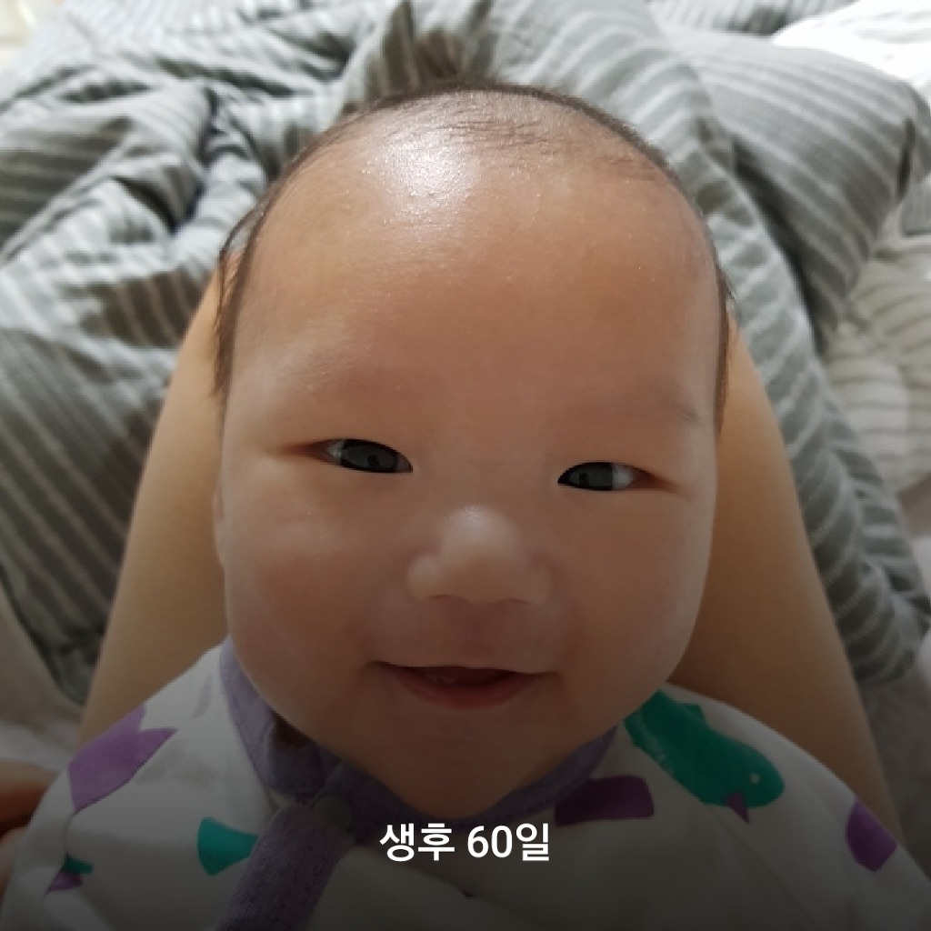 생후 60일