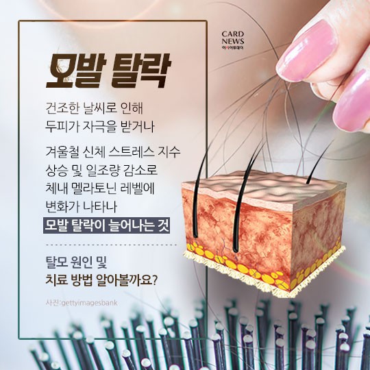 [카드뉴스] “소중한 머리카락 왜 자꾸 빠질까?”... 탈모 원인 및 치료법? 